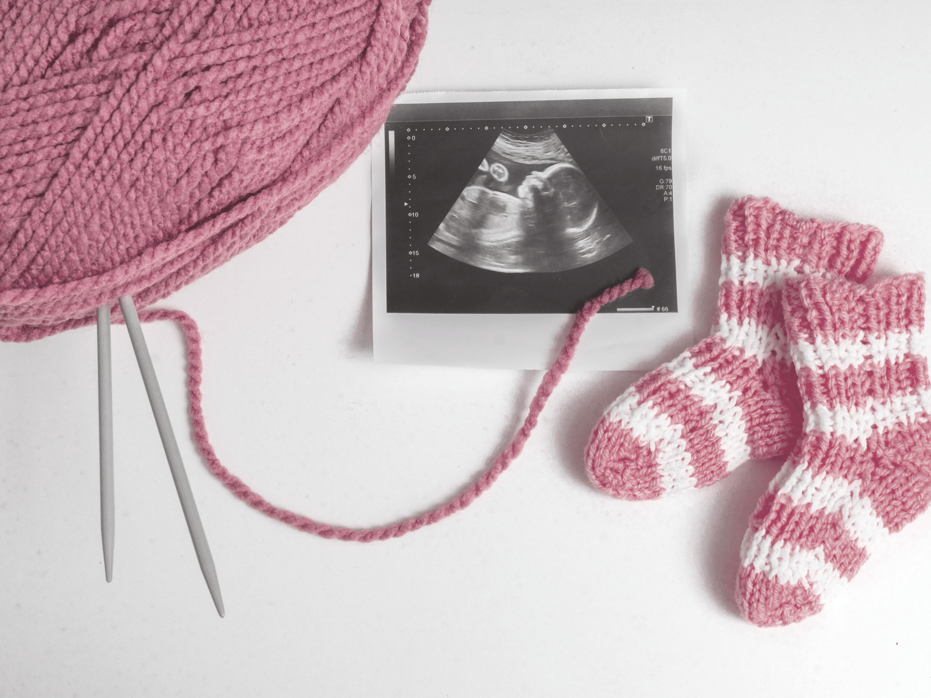 How to Tell your Husband and Family You’re Expecting: Cute Baby Announcement Ideas